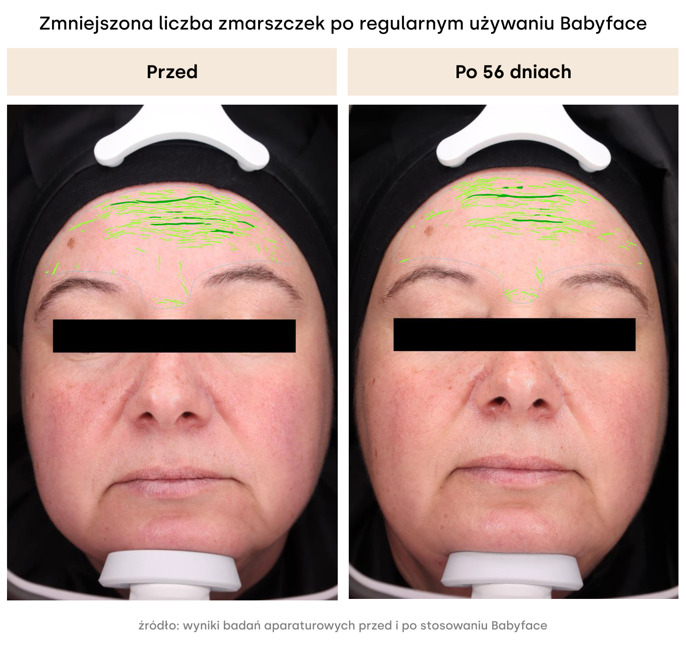 Babyface multikwasowa esencja odnawiająca do twarzy Resibo